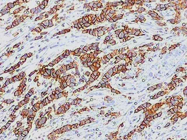 EXAME IMUNO-HISTOQUÍMICO